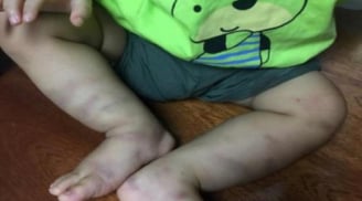 Vụ bé trai 1 tuổi bị bạo hành nghiêm trọng: Kẻ bạo hành cháu bé đã cấu thành tội giết người?