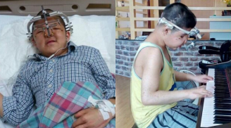 Triệu chứng hội chứng con trai diễn viên Quốc Tuấn mắc phải, hiện nay có rất nhiều trẻ mắc từ khi trong bụng mẹ