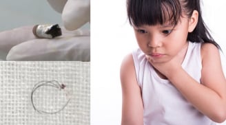 Cảnh giác: Đầu bút chì mắc kẹt ở vùng kín của bé gái 6 tuổi suốt nửa năm mà phụ huynh không hay biết