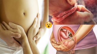 3 thời điểm tuyệt đối không được XOA BỤNG BẦU kẻo SINH NON, XOAY NGÔI THAI NHI