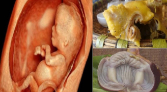 Không muốn THAI NHI CÒI CỌC, CHẾT LƯU, DỊ TẬT, mẹ bầu tuyệt đối cấm ăn 4 bộ phận này trên con gà