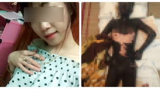 Xót xa thân thể cháy đen của cô gái bị người yêu thiêu sống