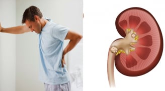 5 thói quen phổ biến ai cũng mắc phải gây hỏng thận bạn nên biết để tránh