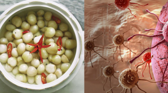 7 loại thực phẩm được CẢNH BÁO gây ung thư cao