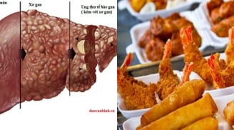 8 loại thực phẩm phá hủy gan nhiều người vẫn ăn hàng ngày