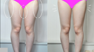 3 thói quen mà bạn vẫn hay mắc phải mỗi ngày khiến mỡ đùi tăng lên nhanh chóng mặt có thể là do