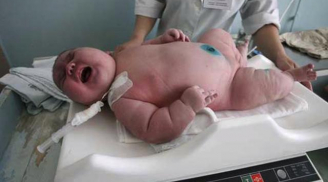 Sản phụ suốt 9 tháng chỉ ăn mì và khoai, không tẩm bổ gì nhưng sinh con gần 8kg khiến ai cũng choáng