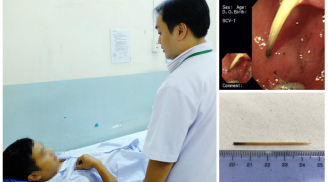 Nam thanh niên 25 tuổi suýt ch.ết vì làm cùng lúc 2 hành động này sau khi ăn bữa trưa