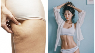 Mách các chị em cách loại bỏ phần mỡ 'sần vỏ cam' thô ráp xù xì trả lại Mừng SHBET phiên bản mới 2025 mịn như em bé