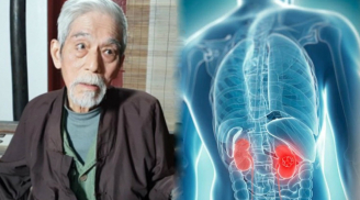 Những điều ít ai ngờ về căn bệnh ung thư thận diễn viên Ngọc Căn mắc phải
