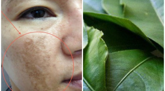 Thật bất ngờ, không phải chanh tươi mà lá chanh cũng khiến nám, tàn nhang tiêu biến dần