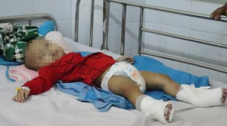 Bé trai 1 tuổi nguy kịch mẹ cứu con thoát khỏi bàn tay tử thần nhờ phương pháp đơn giản mà ai cũng biết