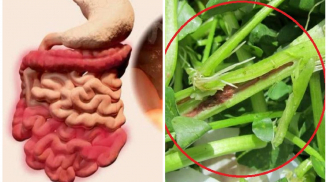 Bác sĩ cảnh báo: Đây chính là 5 loại rau chứa đầy ấu trùng sán bạn tuyệt đối không đưa vào bữa ăn