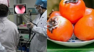 Cảnh báo sau vụ: Dạ dày có 10 viên sỏi to bằng quả trứng vì ăn loại quả nhiều người thích