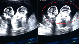 Mới 4 tháng đã CHOẢNG NHAU ‘ầm ầm’ trong bụng mẹ, đây là cặp song sinh đáng yêu đang gây bão mạng xã hội