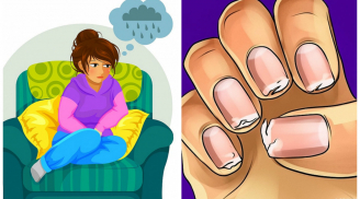 7 dấu hiệu cảnh báo Sh88bet đăng ký miễn phí thiếu canxi trầm trọng, rất nhiều người Việt vẫn cố tình cho qua