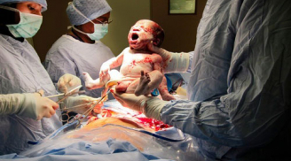 Ám ảnh sau sinh mổ đau đớn thế này: Chị em share về để chồng yêu vợ đọc và yêu thương vợ hơn nhé