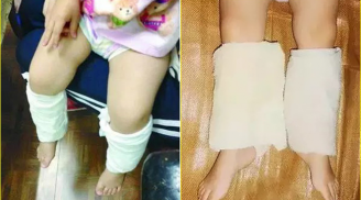 Con sốt mẹ buộc khăn bắp chân khiến ai cũng thấy kỳ lạ nhưng hiệu quả lại vô cùng bất ngờ