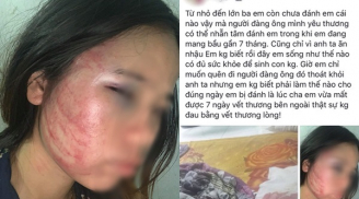 Cô vợ bầu 7 tháng bị chồng nhẫn tâm đánh đập không thương tiếc nhưng điều này mới khiến nhiều người xót thương