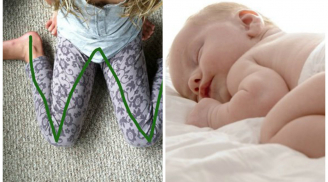 Sai lầm thường gặp của mẹ khiến trẻ chân vòng kiềng, dành 1 phút đọc để bé có một đôi chân như người mẫu