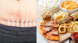 Sau sinh mổ mẹ nhớ tránh 5 loại thực phẩm này nếu không muốn sẹo lồi xấu xí, sữa cạn không đủ con bú