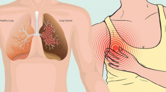 Buổi sáng thức dậy thấy có dấu hiệu này: Hãy tới gặp bác sĩ ngay lập tức kẻo ung thư đang tấn công