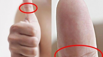 Chỉ cần 5 giây nhìn nhìn ngón tay cái, đoán trúng vận mệnh: 'Giàu nứt đố đổ vách' hay 'nghèo rớt mồng tơi'
