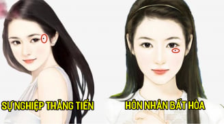 Ngó kĩ 3 nốt ruồi quanh mắt: Đây chính là vị trí 'tụ tài- hút lộc', ai có 1 cái tha hồ hưởng phúc