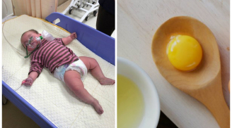 Bé 6,5 tháng ăn trứng xong suy hô hấp: BS cảnh báo dấu hiệu dị ứng mẹ cần biết để con không nguy hiểm