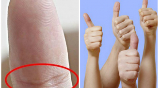 6 dấu hiệu trên ngón cái 'đánh dấu' bàn tay của người nhiều tiền lắm của, tài lộc tự tìm đến tận cửa