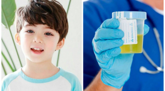 Chẩn đoán bệnh của bé qua màu sắc nước tiểu, mẹ nắm ngay