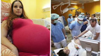 Mẹ bầu vác bụng khổng lồ đi khám, phát hiện 'kỳ tích' 50 năm mới có một lần xuất hiện