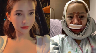 Lưu Đê Ly bất ngờ công khai quá trình Shbet888 tiền thưởng cực khủng thẩm mỹ toàn bộ gương mặt
