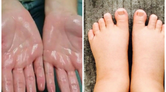 Thấy 4 dấu hiệu này trên Sh88bet đăng ký miễn phí, hãy đi khám ngay kẻo quá muộn