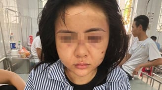 Vụ cô gái bị hành hung suốt 2 giờ đồng hồ: Kết quả giám định thương tích chỉ 2%, nạn nhân bức xúc