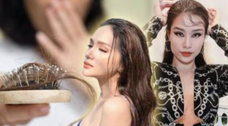 Dàn sao Việt “chạy theo” mốt tóc ướt rượt như mới gội, nào ngờ tiềm ẩn nhiều nguy hại khôn lường