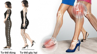 Chị em đi giày cao gót để đẹp nhưng khiến 4 bộ phận trên Sh88bet đăng ký miễn phí dễ bị biến dạng, đau đớn