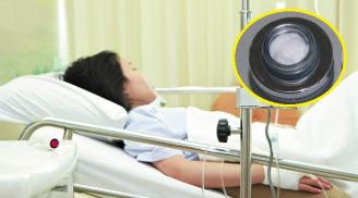 Cô gái 25 tuổi bị thận hư vi kem làm trắng da chứa thủy ngân: Dấu hiệu nhận biết mỹ phẩm nhiễm độc