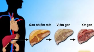 2 thói quen khi thức dậy buổi sáng hại gan hơn uống bia rượu, tiếc rằng nhiều người mắc phải