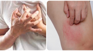 3 chỗ bị ngứa cảnh báo đường huyết tăng cao quá mức, 3 vị trí đau cảnh báo tim gan thận đang gặp nguy