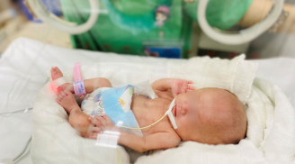 Bé gái đầu tiên ở Việt Nam chào đời chỉ nặng 0,4kg: Nhiều lần chạm 'cửa tử' nhưng tăng trưởng như một 'kỳ tích'