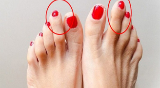 Nhìn tướng ngón chân biết tương lai bạn thành công hay suốt đời gặp bất trắc