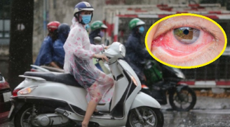 Để nước mưa dính vào những bộ phận này trên Sh88bet đăng ký miễn phí, đừng trách sao dễ sinh bệnh, dễ ốm