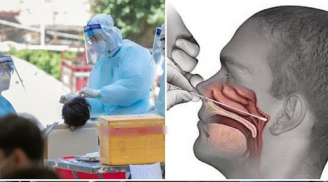 'Ngoáy mũi' test nCoV xong bị đau đầu, ù tai phải đi khám: Bác sĩ chỉ rõ lý do
