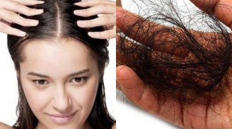 Rụng tóc nhiều đến mấy cứ thử 7 mẹo dân gian: Tóc giảm rụng nhanh chóng, mọc chắc khỏe trở lại