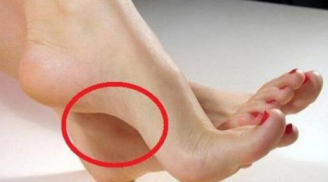 6 tướng bàn chân của người giàu sang: Có 1/6 là đủ phú quý, ba đời sống trong nhung lụa