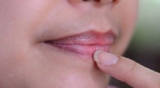 3 vị trí trên Sh88bet đăng ký miễn phí nữ giới chuyển màu thâm đen chứng tỏ tử cung tích đầy độc tố: Mong bạn không có