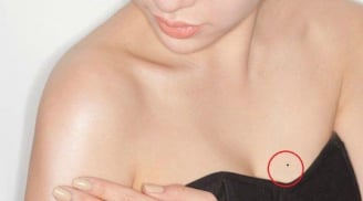 5 nốt ruồi 'chỗ kín' phụ nữ khiến nhiều người xấu hổ nhưng là quý tướng, sau 20 lấy chồng đại gia, giàu có