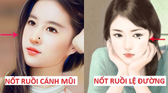 6 nốt ruồi phá tướng khiến chủ nhân nghèo khổ, mãi không ngóc đầu lên được