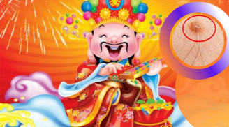Mở mắt đã thấy lông mọc nhiều ở 4 vị trí này trời định giàu sang, tài lộc đến không cản được